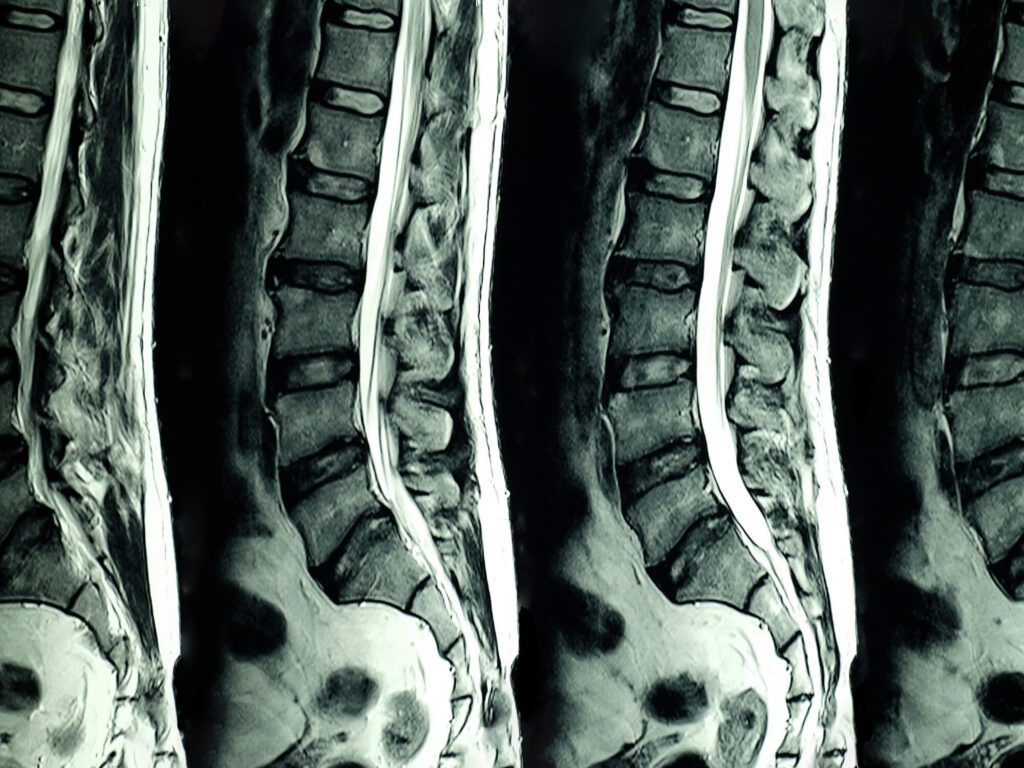 MRI Reports are not always a problem