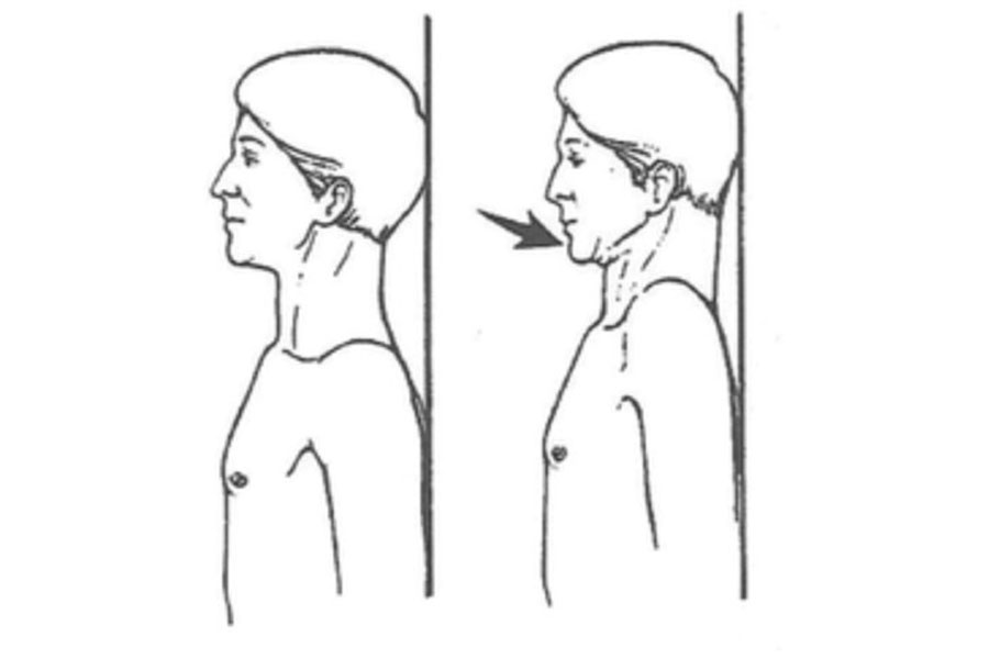 Chin tuck for posture correction